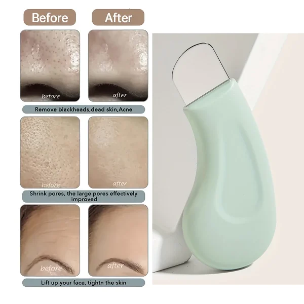 Facial Blackhead Removal Tool Nose Deep Cleansing Remove Acne Handheld Beauty Care Tool Skin Care Auxiliary Tool