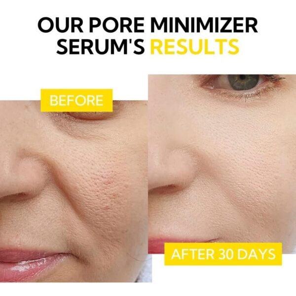 Facial Pores Minimizer Treatment Serum - Image 4